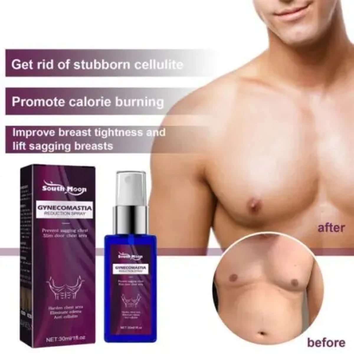 Auchest Gynecomastia Reduction Spray