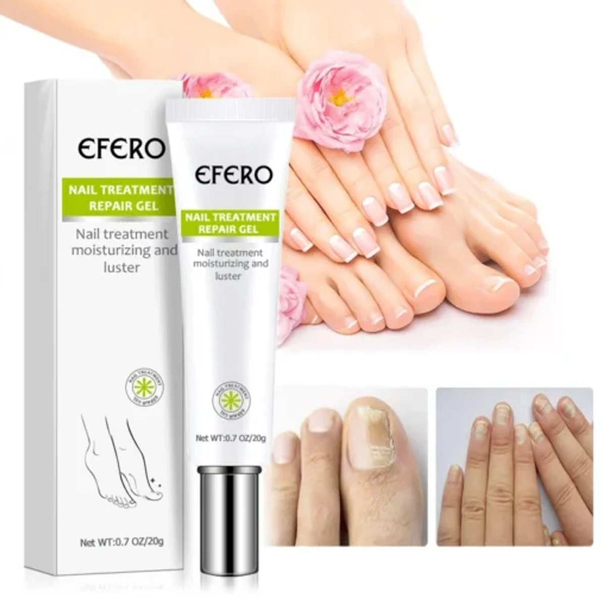 Fungal Nail Treatment Serum