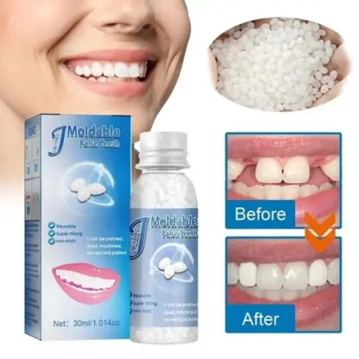 Tooth Repair Kit